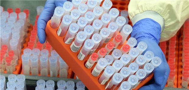 Facharztlabore Uben Scharfe Kritik An Abwertung Der Pcr Tests Im Ebm