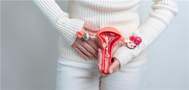 Problembereich Uterus: Adipositas verschlimmert die PCOS-Symptome, aber eine Studie legt nahe, dass Gewichtsabnahme-Interventionen helfen können, indem sie den freien Androgen-Index senken und die Menstruationsfrequenz erhöhen.