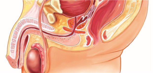 Ist Die Eine Oder Andere Prostata Biopsie Verzichtbar