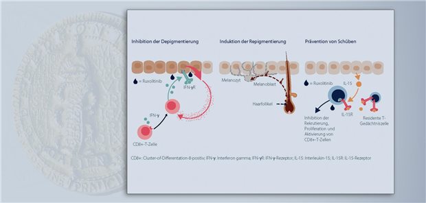 Ruxolitinib inhibiert die IFN--induzierte Signalübertragung, weniger Melanozyten-spezifische CD8+-T-Zellen werden angelockt und die Zerstörung der Melanozyten durch die CD8+-T-Zellen vermindert bzw. unterdrückt.