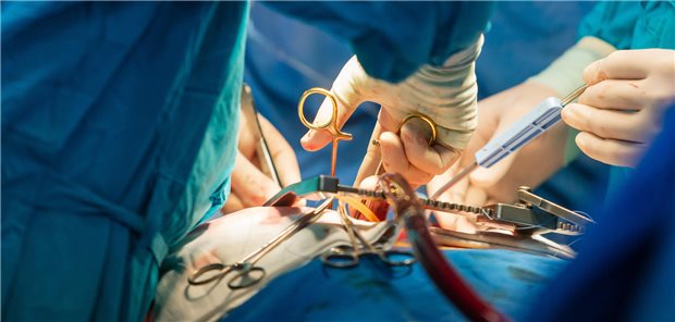 Mittels Gebrechlichkeits-Score lässt sich das Komplikationsrisiko nach Herz-Operation offenbar gut e Chirurgenteam bei der Operation am Herzens eines Patienten im Operationssaal.