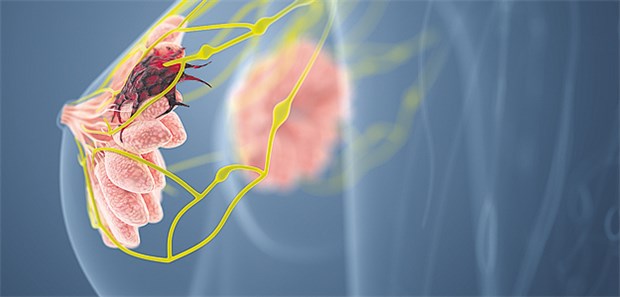 3d Modell Sagt Effekt Der Krebstherapie Vorher