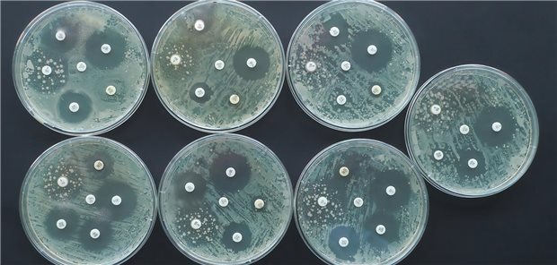 Antibiotikaresistenzen: Fast 10.000 Todesfälle in Deutschland im Jahr 2019 Test auf Antibiotikaresistenzen