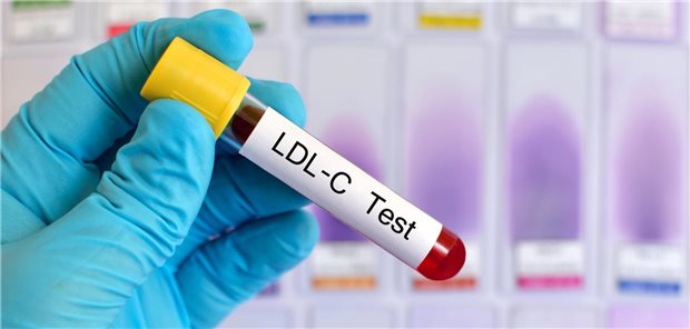 Test auf LDL-Cholesterin im Blut