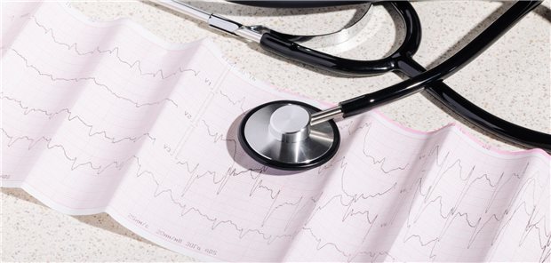 Vorhofflimmern: Kann ein Vorhofohrverschluss die Antikoagulation ersetzen? Das Kardiogramm eines Patienten mit abnormalen Herzrhythmus, das auf Vorhofflimmern hindeutet.