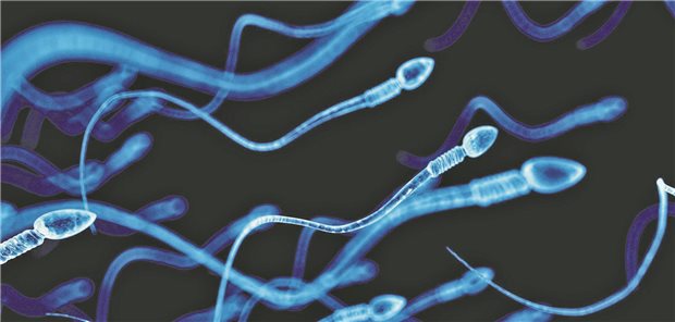 Illustration von Spermien